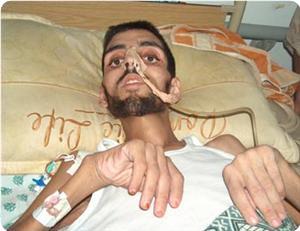 İsrail'in Gazze ablukası öldürüyor