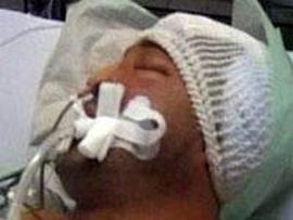 Alman Polisinin Dövdüğü Genç Tıbben Öldü