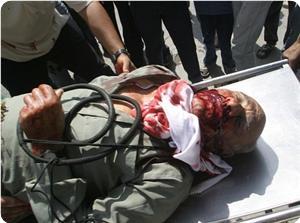 İsrail'in Kanlı Gazze Saldırısı Bitti