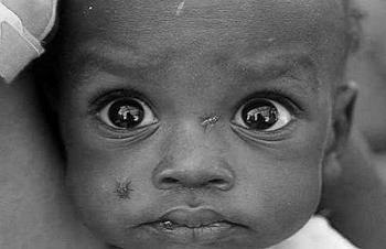 800 Milyon İnsan Aç!