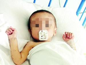 HIV+ Kan Verilen Çocuğun Hakkı ?