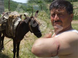 Kendini ısıran, eşeği ısırdı