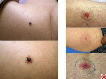 Doktordan skandal kene operasyonu