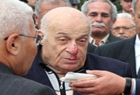 Denktaş hafif yaralandı