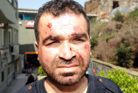 Yanlışlıkla Komaya Soktular (FOTO)