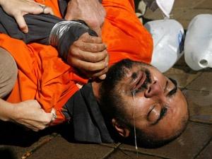 CIA, doktorlar eliyle işkence yaptırmış