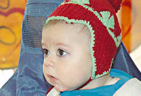 Afgan çocuklara ücretsiz tedavi