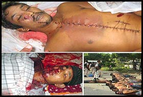 Patani'de Budist Vahşeti