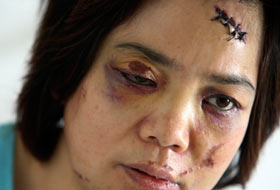 Vahşetten Dün Çekilen Görüntüler (VİDEO)