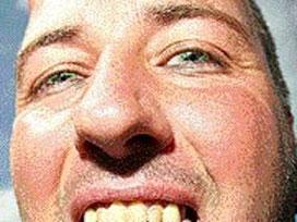 Bu adam dilini kestirip boynuz taktırdı