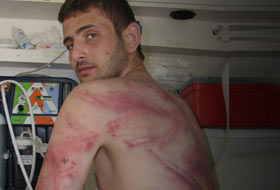 Yunan sahil güvenlik bu hale getirdi