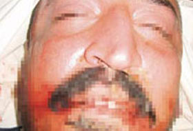 Belçika Sessizliğini Bozdu