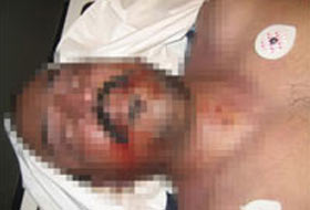 Hasta olduğunu bile bile işkence yaptılar