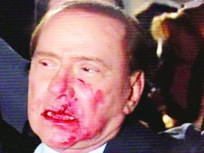 Berlusconi'ye yumruklu saldırı