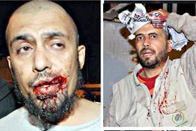 İşte Gazze Sınırındaki Dehşet Anı(VİDEO)