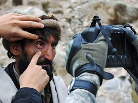 Gözlerinden Fişliyorlar