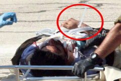 Yaralılara kelepçe taktılar!