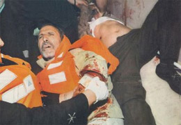 Otopsi raporu: Helikopterden gemiye ateş açılmış