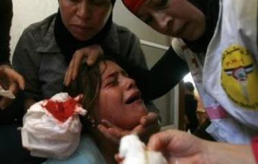 "Mavi"yi Savundu Gözünden Oldu(FOTO)