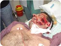 Kudüs'de Sıcak Saatler 1 Şehid