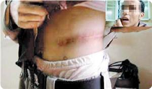 Organ Hırsızı İsrail!