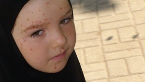 Unutulmuş Çeçen Kampı(FOTO)