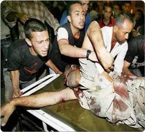 İsrail Gazze'ye Saldırdı:11 Yaralı