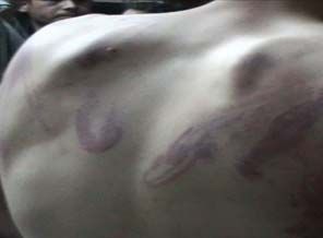 Suriye'de İşkence Yaş Sınırı Tanımıyor