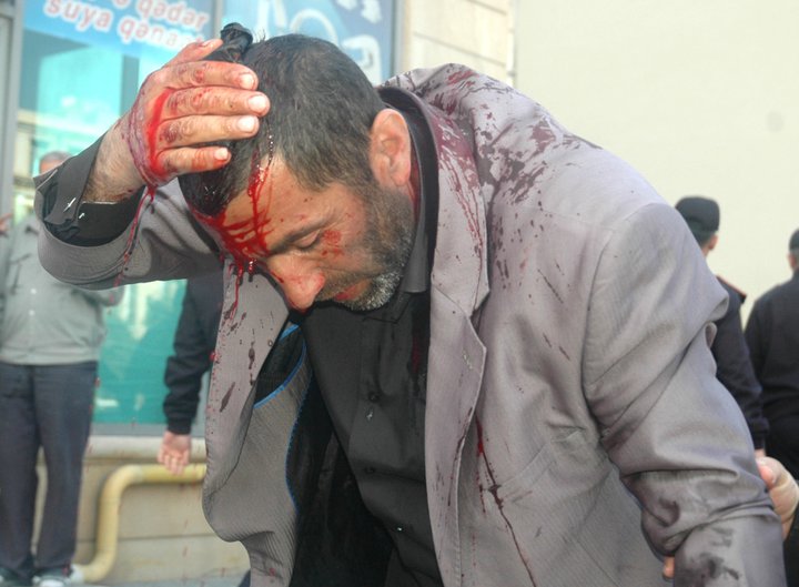 Azerbaycan'da Kan Aktı-FOTO-VİDEO