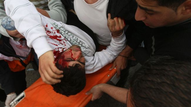 Toprak Günü Kana Bulandı(VİDEO)