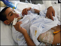 Lübnan'da 3 çocuk yaralandı