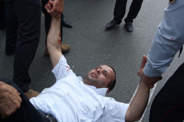 Azerbaycan Elçiliği Kuşatılıyor