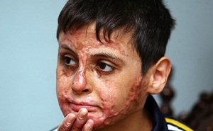 Evimizi Harap Etmiş Olsalar da...