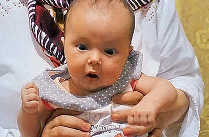 Bebek Felçli Doğacak Dediler Ama...