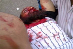 Mısır'da Direniş Günü(CANLI TAKİP)