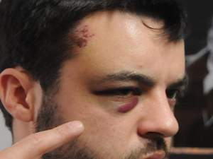 "Bizi 15 dakika dövdüler,şikayetçiyiz”