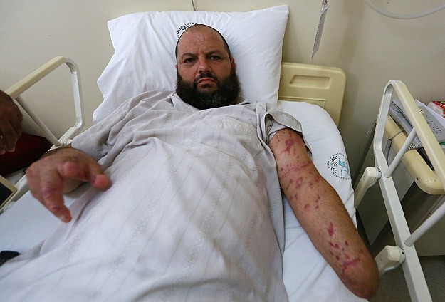 Diyabet hastası olduğunu Türkiye'de öğrendi