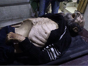 Esed'in Bombaları ve Açlık Öldürüyor!