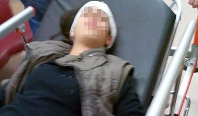 Gazi Mahallesinde Çocuk Vuruldu