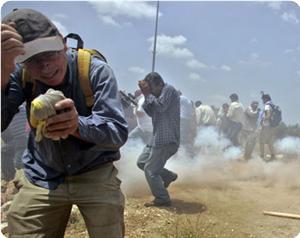 Kefer Kadum'da Yaralanan Gençlerden Biri Gözünü Kaybetti
