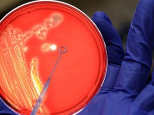 ABD'deki Şarbon Krizi Büyüyor