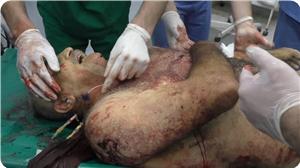 İşgal Güçleri Yaşlı Bir Filistinliyi Şehit Etti