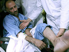 İşkence edilen İranlı diplomatın ilk görüntüleri FOTO