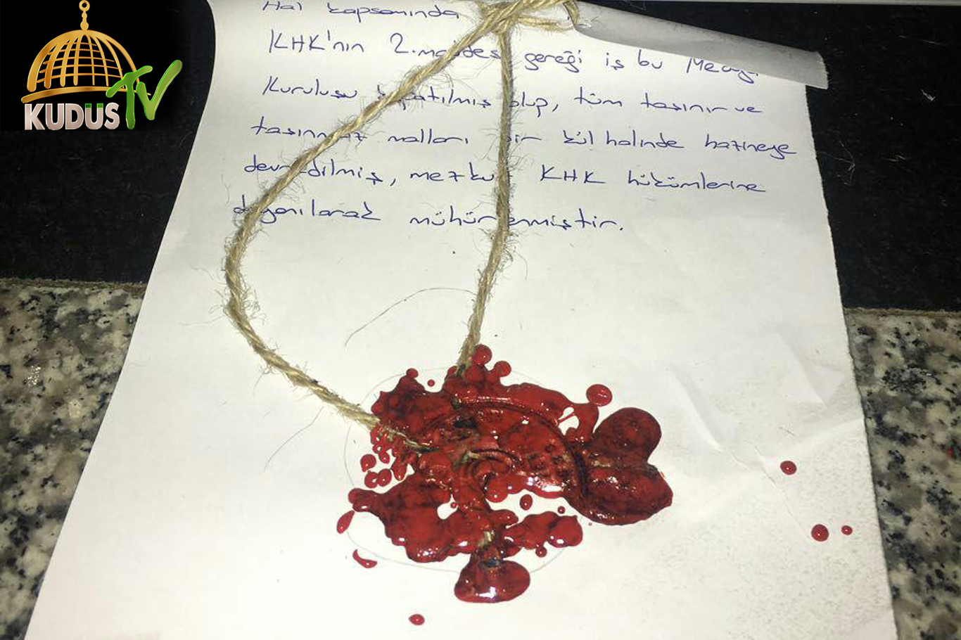 HÜDA PAR'dan Basın Özgürlüğü Uyarısı