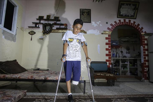 Gazzeli Çoçuk : Bacağımı Kaybedecek Hangi Suçu İşledim?