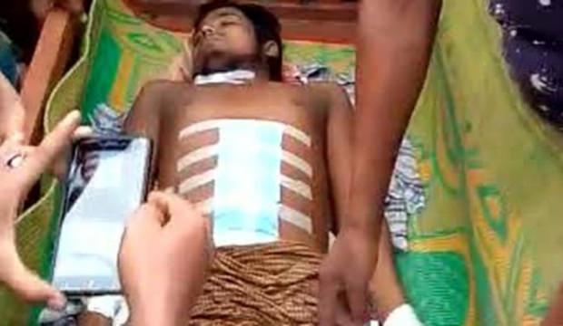 Arakan'da Vahşet (VİDEO)