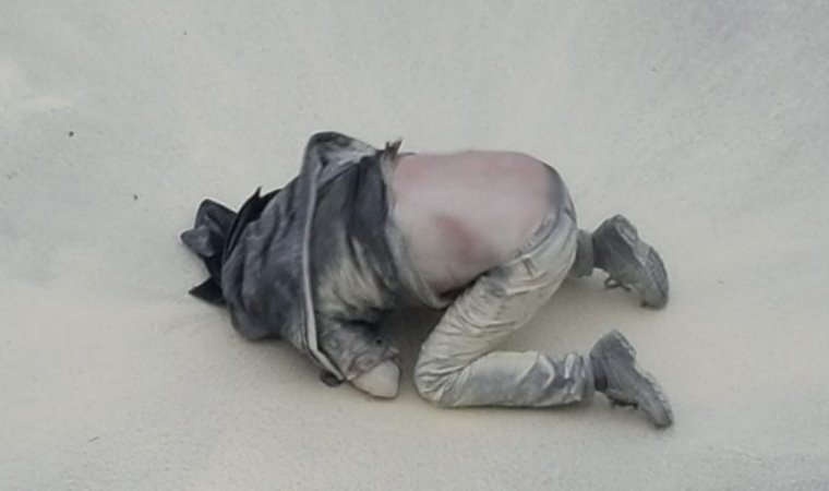 Çocuklarım Aç’ Diyerek Kendisini Yakan Vatandaş Hayatını Kaybetti