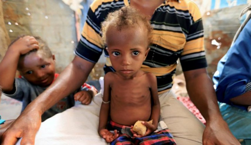 UNICEF: Ekonomik Çöküş Yemen'deki insani Krizi Alevlendiriyor