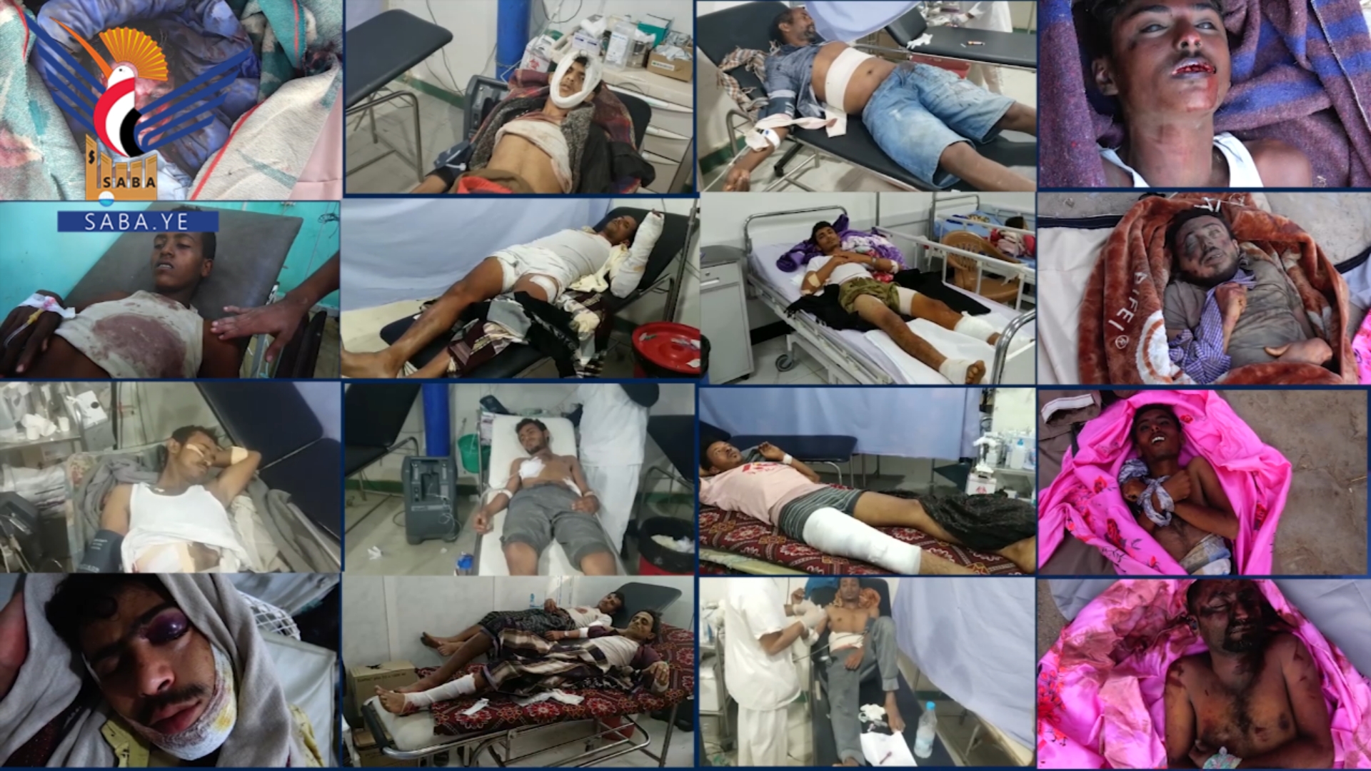 Suudi Arabistan Yemen'de Katliam  Yaptı :  2 bin 909 Kişi  Öldü