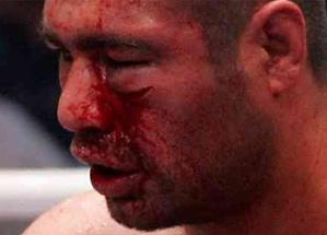 Spor Dediğiniz Bu Mu ?